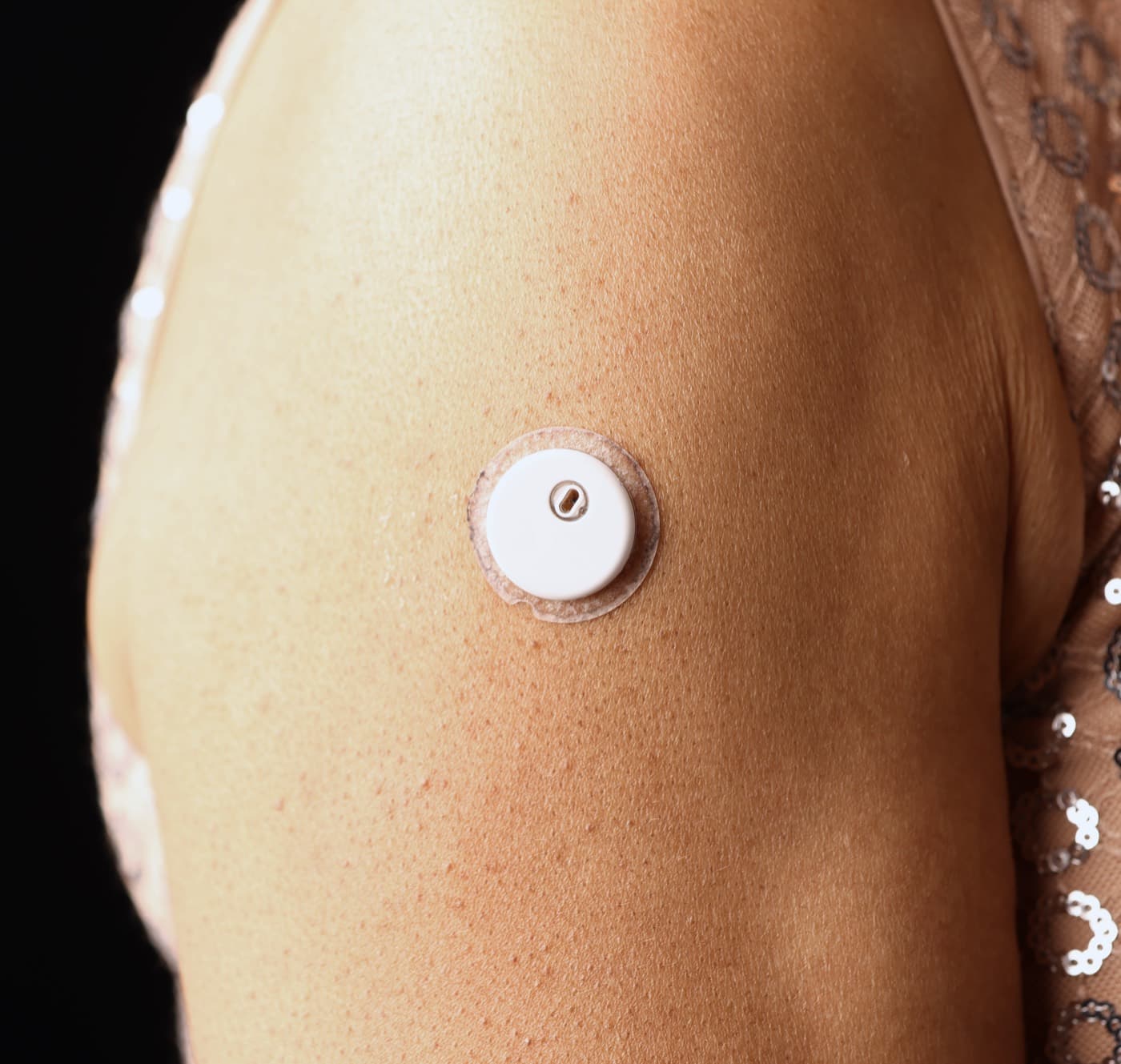A close-up of a small, round CGM sensor worn on the arm
